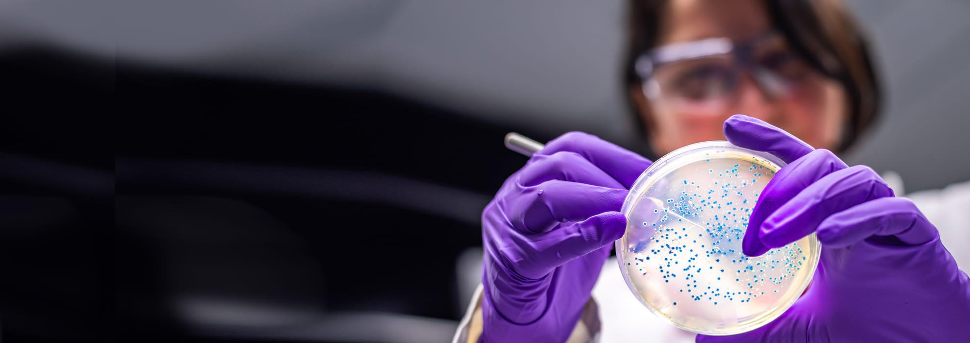 Woman wearing gloves and using petri dish in lab. 